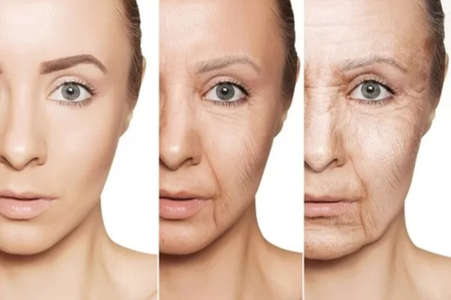 Phục hồi làn da chảy xệ: Giải pháp giúp da căng mịn nhanh chóng