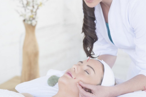 Châm cứu trẻ hóa da mặt - phương pháp làm đẹp tự nhiên được ưa chuộng